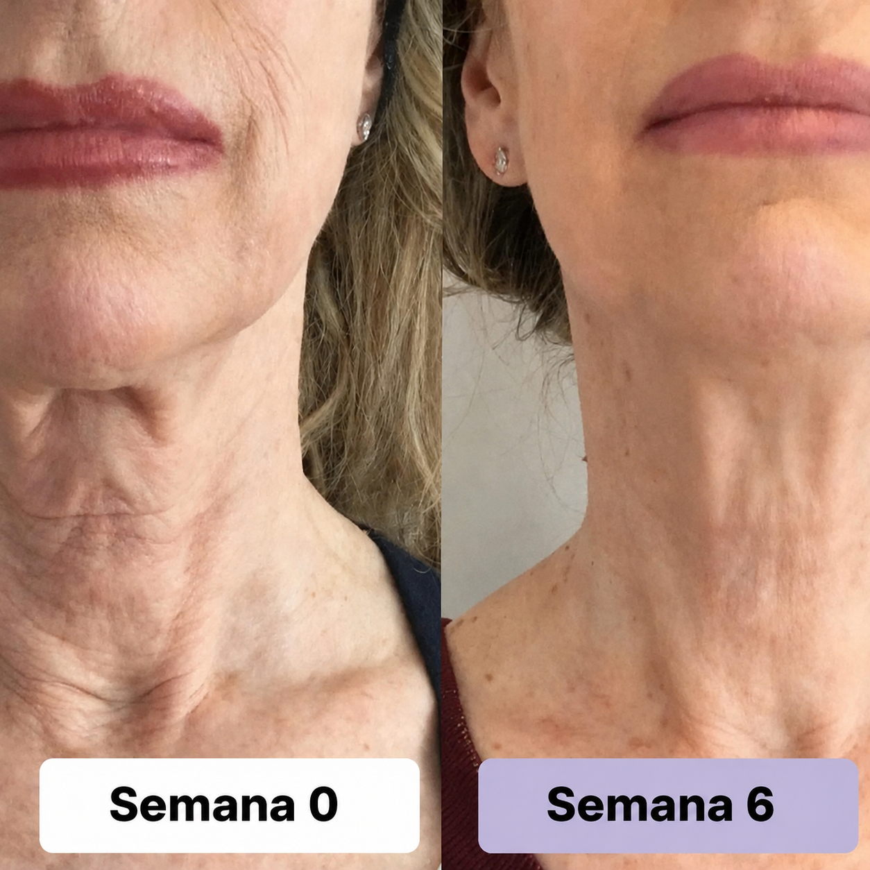 4. La solución para el cuello tras perder peso que las mujeres esperaban