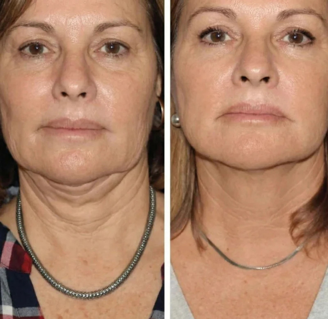 3. No solo mejora tu cuello: cambia cómo te sientes contigo misma